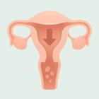 ЭКО при менопаузе