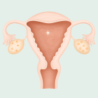 ЭКО при низком АМГ