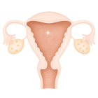 ЭКО при низком АМГ