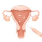 ЭКО в естественном цикле