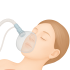 Наркоз при ЭКО