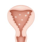 Подготовка эндометрия к ЭКО