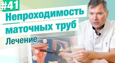 Лечение непроходимости маточных труб