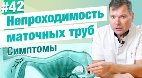 Симптомы непроходимости маточных труб